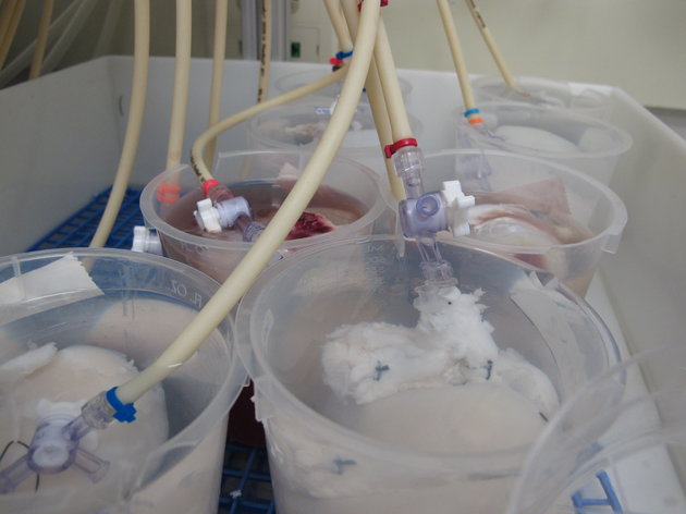 维克森林大学的实验室里，正在清洗猪肾。他们希望找到替代人类器官的方法。
