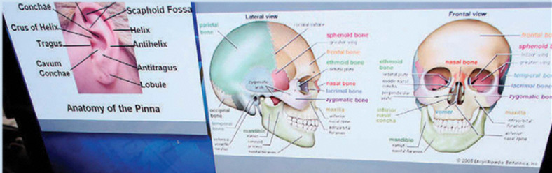 纽约警察局面部识别科里老式的人脸识别图表，展示出人类头部的解剖特征。
