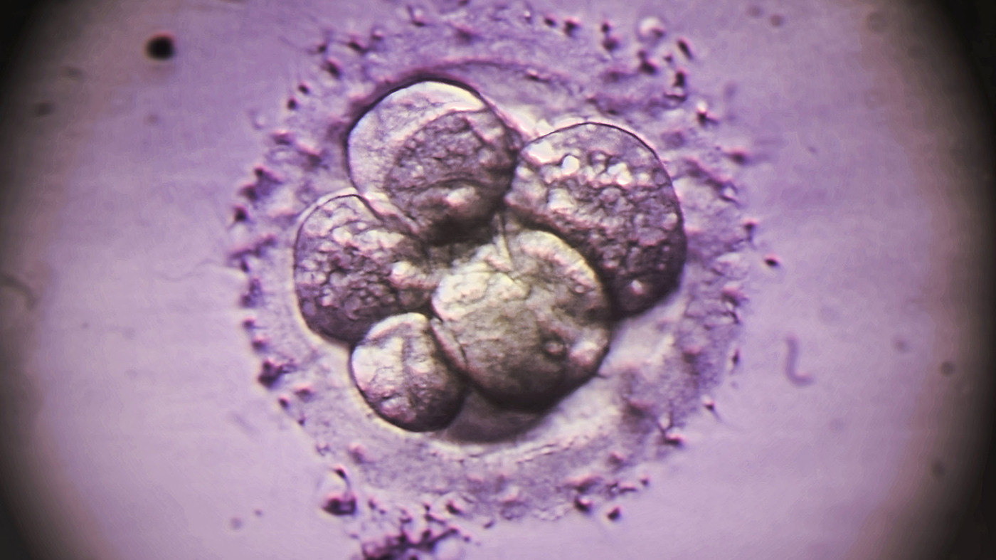 It's now possible to edit the DNA in a human embryo. The next question is, should we?